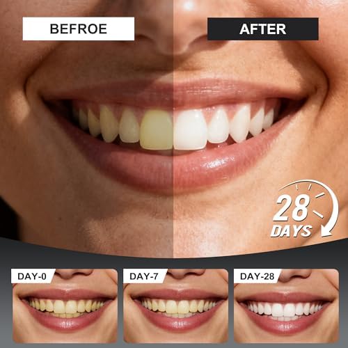 Tabletas de Pasta Dental Woadee 7.5% Nano Hidroxiapatita - Reparación de Esmalte, Blanqueamiento Sin Flúor, Sabor Menta, 62 Piezas - imagen 4