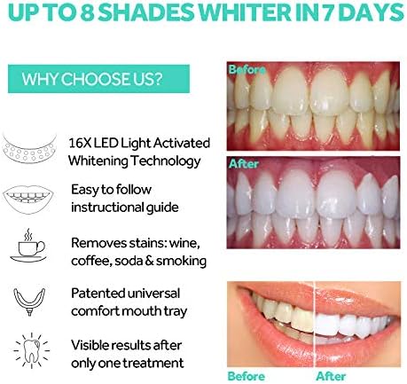 Luz Aceleradora para Blanqueamiento Dental, Luz LED Azul 16x Más Potente, Bandeja Bucal Conectada a iPhone/Android para Uso en Casa - imagen 3