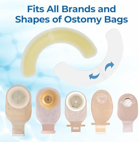 Sunliech 20 Piezas de Tiras Elásticas para Barrera de Ostomía, Hidrocoloide Médico, Suministros para Ostomía, Cinta Adhesiva Impermeable para Bolsa - imagen 6