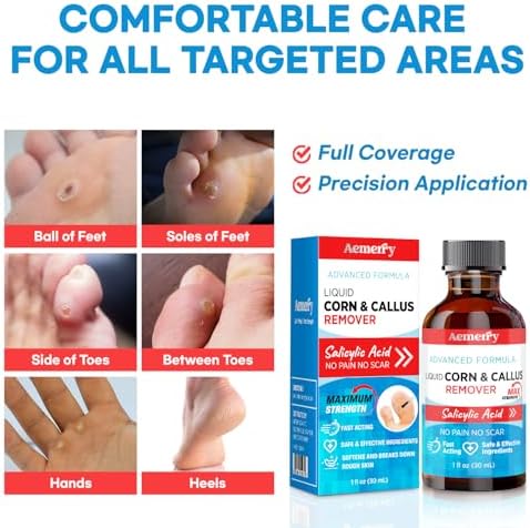 Aemerry Removedor de Callos para Dedos de Pies: Ácido Salicílico 17% Extra Fuerte, Acción Rápida, 30ml - imagen 2