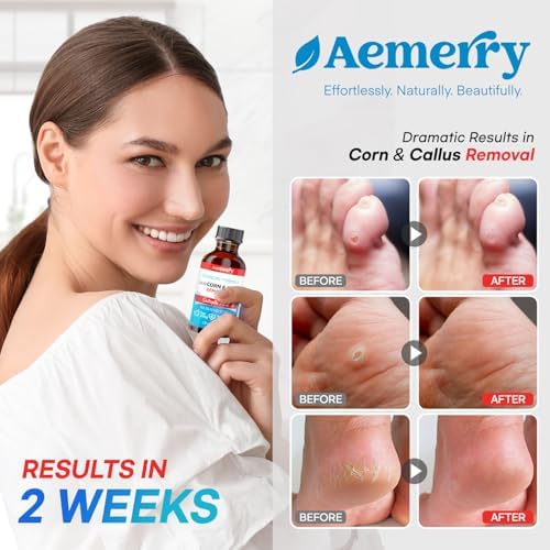 Aemerry Removedor de Callos para Dedos de Pies: Ácido Salicílico 17% Extra Fuerte, Acción Rápida, 30ml - imagen 5