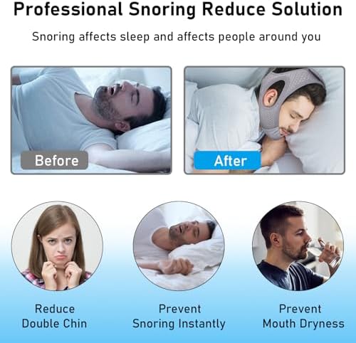 Cinta Anti Ronquidos Forzacx - Correa Ajustable y Cómoda para CPAP, Reduce Eficazmente los Ronquidos, Color Gris - imagen 2