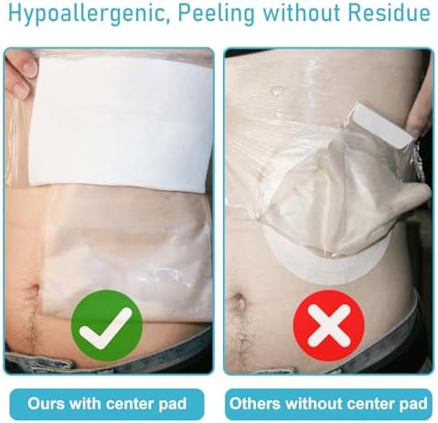 KONWEDA 25 Pzs Funda Impermeable para Bolsa de Ostomía 10x10, Protector de Baño para Estoma con Adhesivo y Vendaje para Suministros de Ostomía - imagen 4