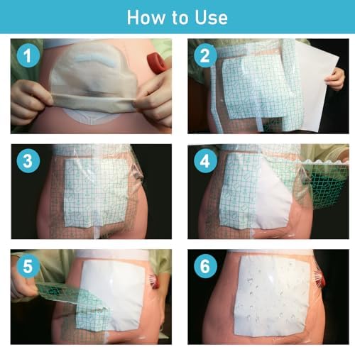 KONWEDA 25 Pzs Funda Impermeable para Bolsa de Ostomía 10x10, Protector de Baño para Estoma con Adhesivo y Vendaje para Suministros de Ostomía - imagen 6