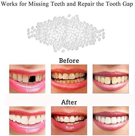 Kit de Reparación Dental - Perlas Térmicas para Rellenar y Arreglar Dientes Faltantes o Adhesivo para Dentaduras Falsas - imagen 2