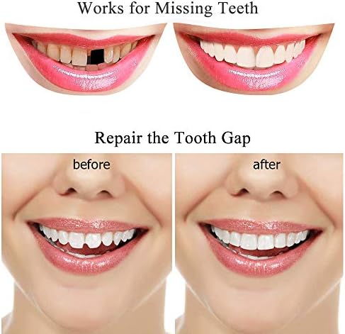 Kit de Reparación Dental - Perlas Térmicas para Rellenar y Arreglar Dientes Faltantes o Adhesivo para Dentaduras Falsas - imagen 3