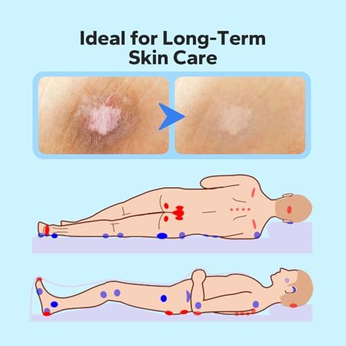 Crema para Úlceras por Presión ViloVila (60 g), Tratamiento Rápido para Úlceras en los Glúteos, Ungüento para Cuidado de Heridas y Piel Irritada - imagen 6