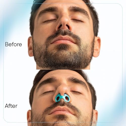 Dilatadores Nasales BABURI para Dormir – Dilatador Nasal Interno y Abre Nariz, Conos Nasales para Respirar, Válvulas de Silicona Reutilizables para - imagen 3