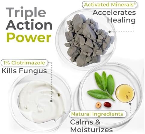Tratamiento para Pie de Atleta Terrasil con Clotrimazol Clínicamente Comprobado, Crema Antifúngica de Fuerza Extra para Hombres y Mujeres, Alivia - imagen 5