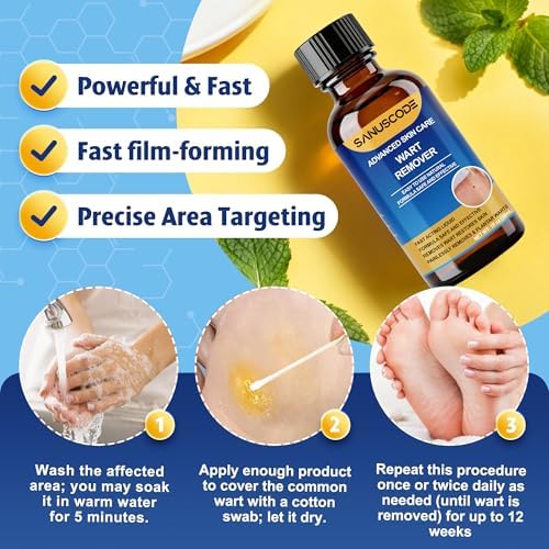 Sanuscode Removedor de Verrugas Líquido con 17% de Ácido Salicílico, Kit de Eliminación Rápida para Verrugas Plantares y Comunes, 30 ml - imagen 2