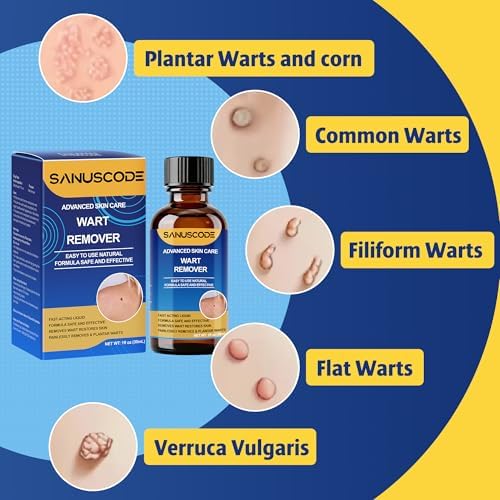 Sanuscode Removedor de Verrugas Líquido con 17% de Ácido Salicílico, Kit de Eliminación Rápida para Verrugas Plantares y Comunes, 30 ml - imagen 3