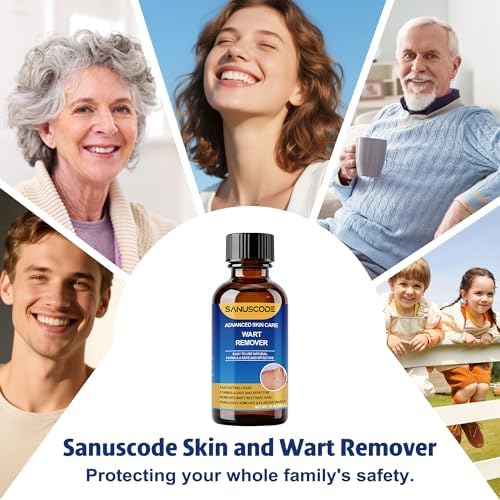 Sanuscode Removedor de Verrugas Líquido con 17% de Ácido Salicílico, Kit de Eliminación Rápida para Verrugas Plantares y Comunes, 30 ml - imagen 7