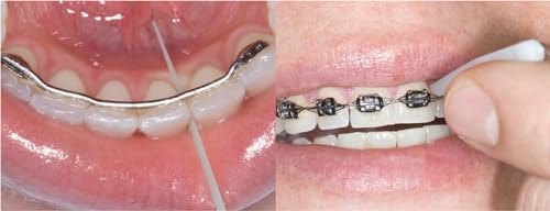 Palillos Dentales ULTRADENT OpalPix (3 Paquetes) 32ct por Paquete. Palillos de Dientes Opalescence GO Cuidado Oral Suaves. 5590-3 - imagen 6