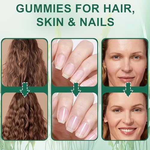 Gomitas para la Caída del Cabello YATIME con Musgo Marino, Vitamina C, E, Aloe Vera y Polvo de Perla - 60 Unidades, Sin Gluten - imagen 6