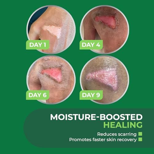 TURFGUARD Hydrogel para Quemaduras con Plata X-Static – Alivio Refrescante, Aprobado por la FDA, Protección Antimicrobiana y Parche Hidratante para - imagen 6