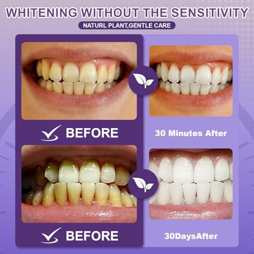 Tiras Blanqueadoras de Dientes Moradas - Seguras para Esmalte y Dientes Sensibles - Tecnología de Tiras Secas Antideslizantes - 15 Tratamientos / 30 - imagen 3