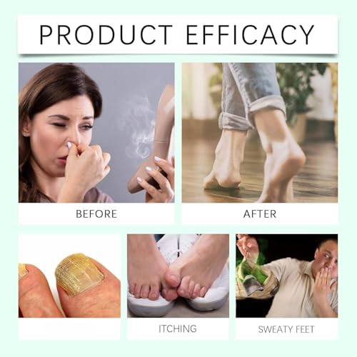 Spray para pies Ximonth con aceite de árbol de té, 2 piezas, 100ml/3.38fl.oz - imagen 7
