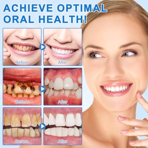 Pasta Dental Hydroxiapatita 2PZ para Protección del Esmalte, 9.9% Nano-Hidroxiapatita, Restaura Esmalte, Reduce Sensibilidad, Blanquea y Aclara - imagen 4