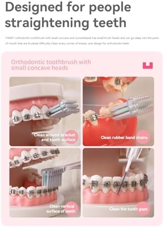 Cepillo de Dientes Ortodóntico Cóncavo YANDY para Brackets, Paquete de 3, Cepillo Interdental Autocontenido, Cerdas Suaves - imagen 3