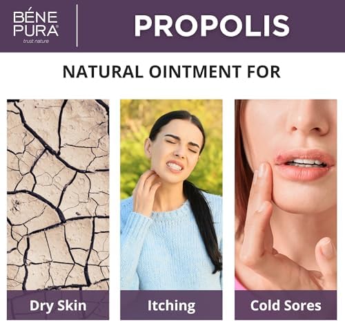 Ungüento BenePura con Propóleos - Crema Natural Antipicazón con 30% Propóleos - Alivio para Picazón y Erupciones - Crema Hidratante para Piel Seca y - imagen 2