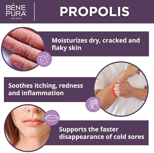 Ungüento BenePura con Propóleos - Crema Natural Antipicazón con 30% Propóleos - Alivio para Picazón y Erupciones - Crema Hidratante para Piel Seca y - imagen 3