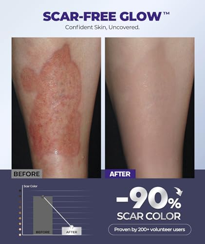 Crema de Silicón para Cicatrices con 6.7% de Ingredientes Activos, Gel para Cicatrices Visible en 2 Semanas, Hidratante para Remoción de Cicatrices - imagen 5