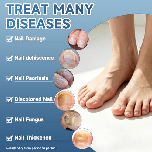 Tratamiento para Hongos en Uñas BeamBalm Extra Fuerte - Acción Rápida para Uñas de Manos y Pies - Restaura y Repara Uñas Dañadas y Descoloridas - imagen 2