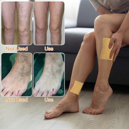 Parches Wanban de Cúrcuma para Varices - 48 Piezas, Tratamiento Natural para Piernas y Arañas Vasculares - imagen 2