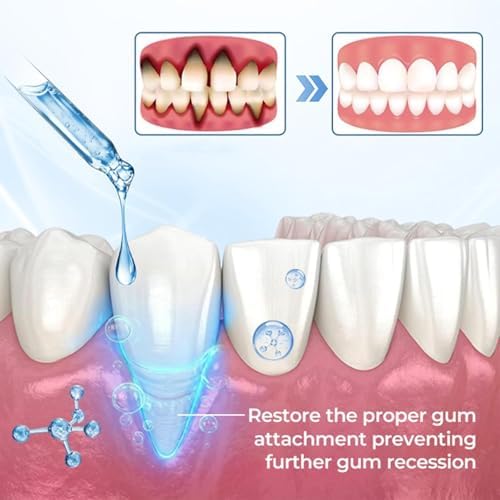 Solución Oral Beerakt de 2 Piezas, Enjuague Bucal Sabor Menta, Mejora la Higiene Oral y Proporciona Aliento Fresco Duradero, Cuidado Bucal Diario - imagen 2