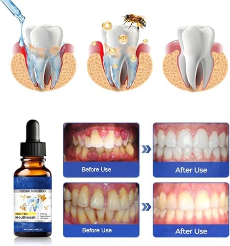 Solución Oral Beerakt de 2 Piezas, Enjuague Bucal Sabor Menta, Mejora la Higiene Oral y Proporciona Aliento Fresco Duradero, Cuidado Bucal Diario - imagen 4