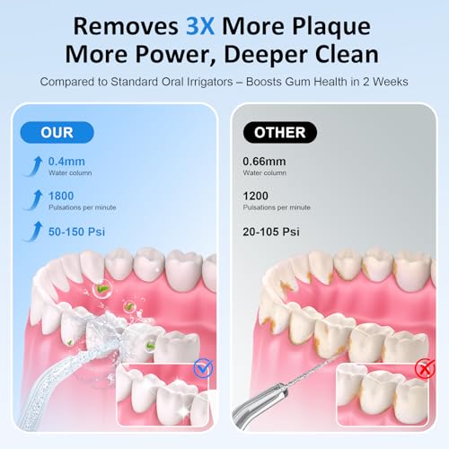 Hilo Dental de Agua – Irrigador Oral Inalámbrico de 300ML con 6 Puntas Intercambiables, 3 Modos, Recargable y Portátil, Ideal para Brackets y Encías - imagen 2