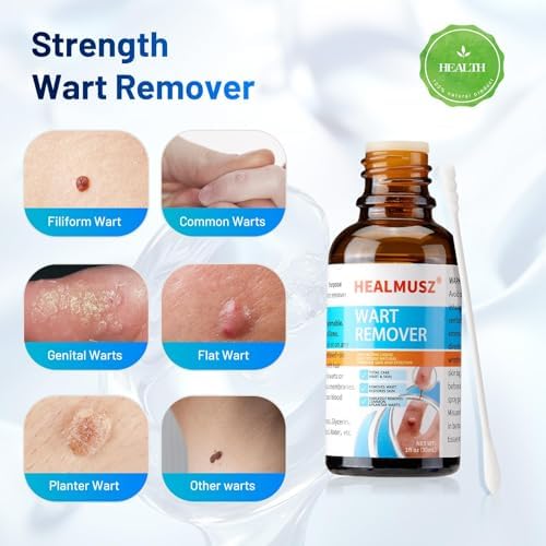 HEALMUSZ Líquido Removedor de Verrugas Plantares y Callos con 5% de Ácido Salicílico, Eliminación Rápida de Verrugas Genitales en Pies, Ideal para - imagen 4