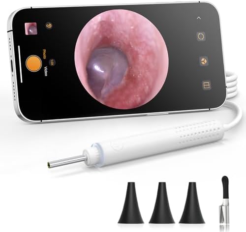 Otoscope ScopeAround con Luz, Cámara HD 720P para Limpieza de Oídos, 6 Luces LED, Endoscopio Digital, Conexión USB-C, Plug & Play - imagen 1
