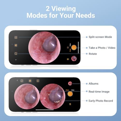 Otoscope ScopeAround con Luz, Cámara HD 720P para Limpieza de Oídos, 6 Luces LED, Endoscopio Digital, Conexión USB-C, Plug & Play - imagen 5
