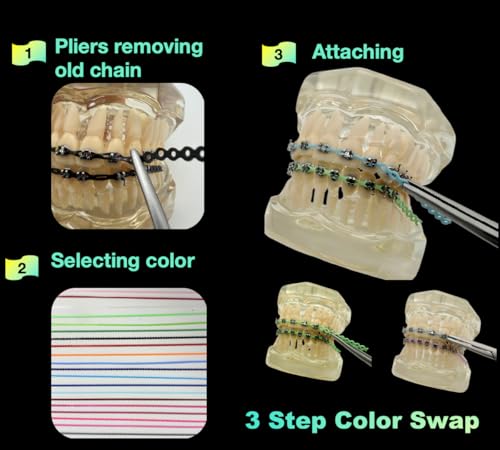 2BDENT Paquete de 20 Cadenas de Poder Coloridas (Continuas) para Frenos, Bandas Elásticas Ortodónticas de 20 cm con Pinzas, Reemplazo DIY para - imagen 3