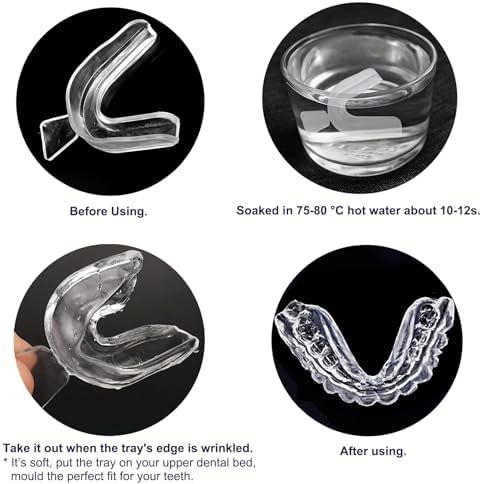 Kit de 10 Bandejas para Blanquear Dientes con 2 Cajas para Dientes, Bandejas Moldables y Herramientas de Cuidado Oral - imagen 3