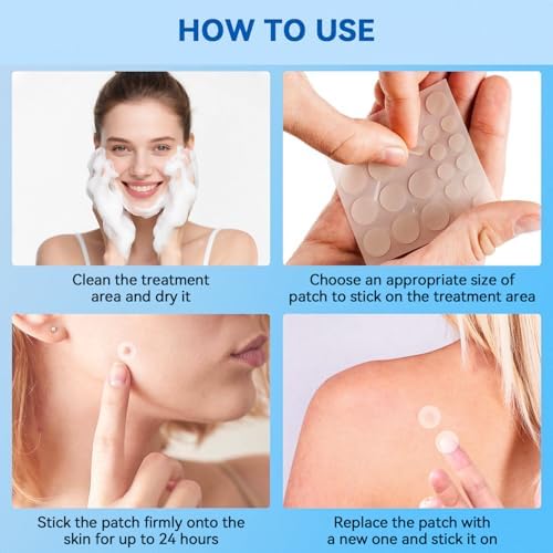SAKIMA Removedor de Verrugas, Parche Hidrocoloide Impermeable Invisible, Fácil de Usar, Apto para Todo Tipo de Piel, 144 Piezas - imagen 7