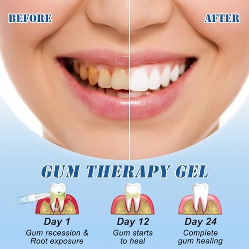 Gel Terapéutico para Encías Neslemy™ - Pack de 3, Gel Blanqueador de Dientes y Tratamiento Instantáneo para Encías Dentizen - imagen 4