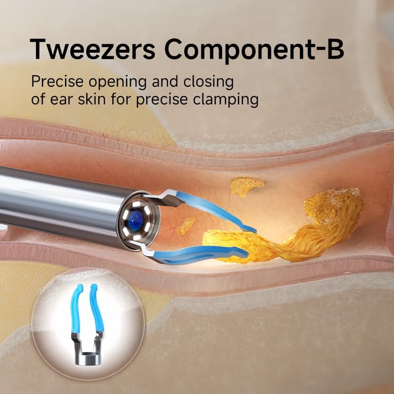 Puntas de Repuesto Bebird para Limpieza de Oídos, 14 Piezas de Silicón Impermeable para Remoción de Cerumen, Compatible con Earsight Plus - imagen 5