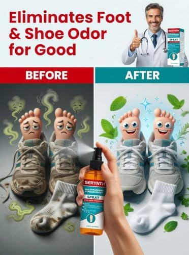 Spray Antifúngico para Pies y Calzado, Tratamiento para Hongos en los Pies, Picazón, Ampollas y Olores (100ML) - imagen 2