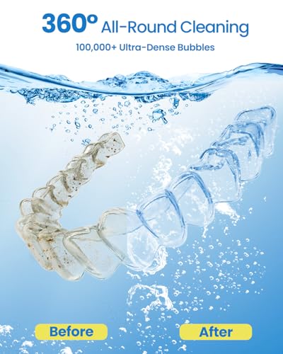 Limpiador Ultrasónico Mejorado para Retenedores, 2X Eficiencia, Máquina de Limpieza de Dentaduras 45kHz con Luz UV y 4 Modos, Estuche para - imagen 2