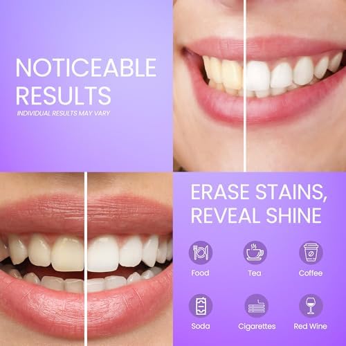 Tiras Blanqueadoras AFD Purple para Manchas de Café y Dientes Amarillos, Sin Peróxido, 14 Tratamientos (28 Tiras), Blanqueo en Casa de 30 Minutos - imagen 2