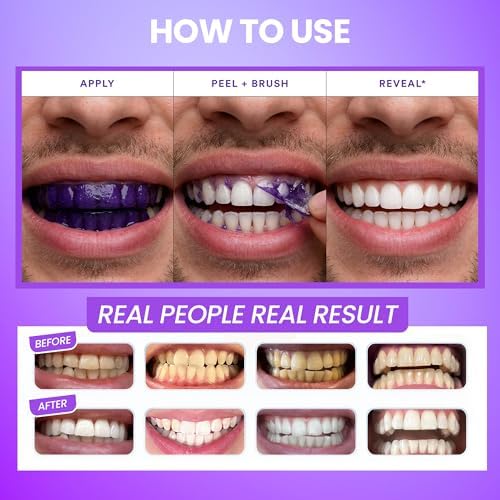 Tiras Blanqueadoras AFD Purple para Manchas de Café y Dientes Amarillos, Sin Peróxido, 14 Tratamientos (28 Tiras), Blanqueo en Casa de 30 Minutos - imagen 4