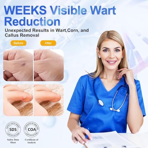 HEALMUSZ Líquido Quitapapilomas 5% Ácido Salicílico, Eliminador de Verrugas para Genitales, Comunes, Planas, Durezas y en Pies - imagen 4