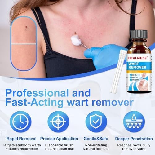 HEALMUSZ Líquido Quitapapilomas 5% Ácido Salicílico, Eliminador de Verrugas para Genitales, Comunes, Planas, Durezas y en Pies - imagen 5