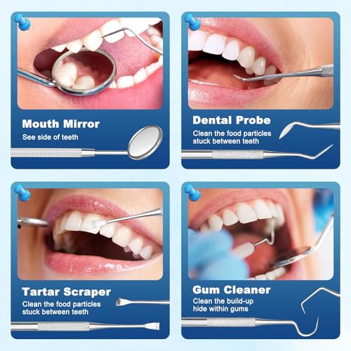Kit de Reparación Dental con 4 Herramientas, Perlas Moldeables para Soluciones Instantáneas y Sonrisas Seguras - 1Q - imagen 2