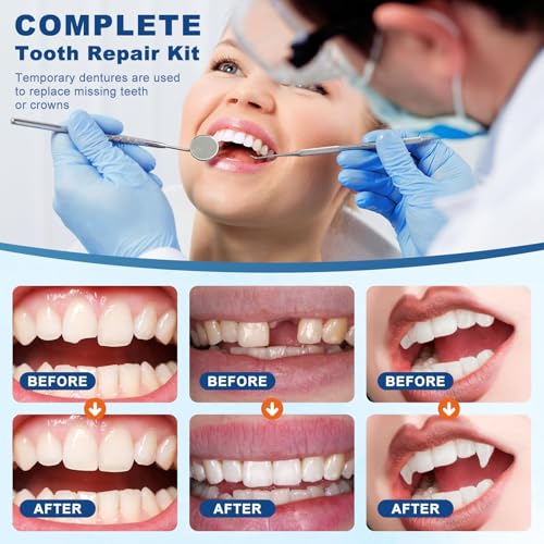 Kit de Reparación Dental con 4 Herramientas, Perlas Moldeables para Soluciones Instantáneas y Sonrisas Seguras - 1Q - imagen 6