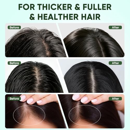 Aceite de Batana CADDISE para el Crecimiento del Cabello - 100% Puro y Natural, Pasta de Batana de Honduras para Cabello Más Fuerte y Abundante, - imagen 4