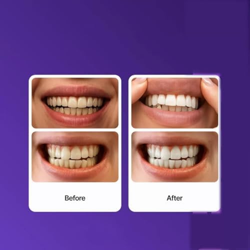 Tiras Blanqueadoras de Dientes Moradas, 14 Tiras, Reducción Suave de Manchas Diarias y Brillo Natural, Portátiles para el Hogar y Viajes - imagen 8