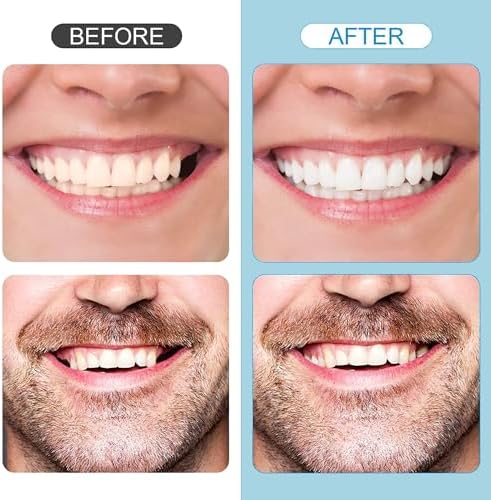 Kit de Reparación Dental, Sombra Natural Temporal para Rellenar Espacios, Kit de Perlas Térmicas Moldables para Reemplazar Dientes Faltantes o Rotos - imagen 7